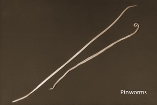 Illustration for article titled How to Kill a Parasitic Worm Living Inside of You
